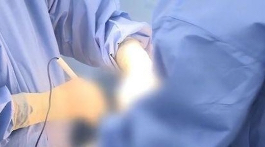 수술 장면. 기사와 직접적인 관련 없음.<연합뉴스>